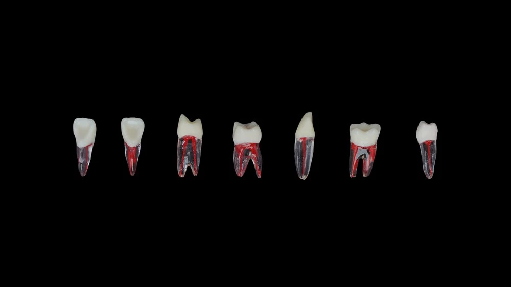 Plastik Endodontik Diş Seti